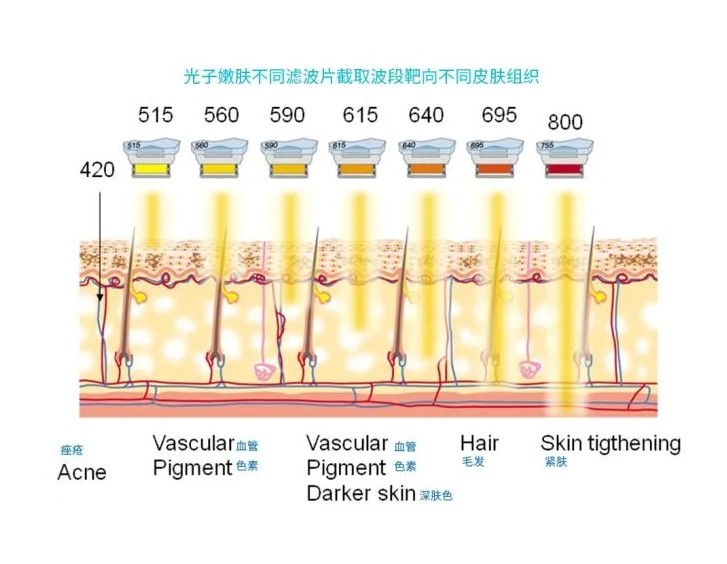 五大光子嫩膚技術(shù)（IPL、DPL、OPT、APT、BBL）及濾光片區(qū)別